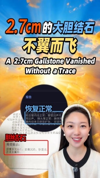 2.7cm的大胆结石，不翼而飞.mp4